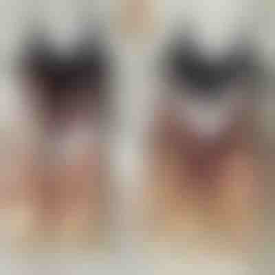 Комплект безшевни сутиени | BRAPACK